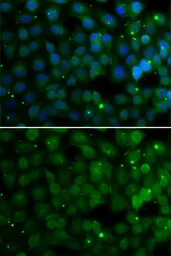 Anti-HPD antibody used in Immunocytochemistry/ Immunofluorescence (ICC/IF). GTX33247