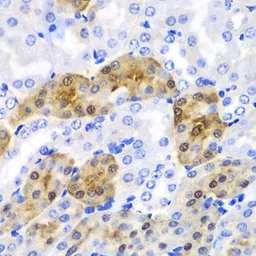 Anti-HPD antibody used in IHC (Paraffin sections) (IHC-P). GTX33247