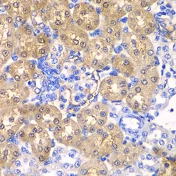 Anti-HPD antibody used in IHC (Paraffin sections) (IHC-P). GTX33247
