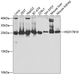 Anti-ERAB antibody used in Western Blot (WB). GTX33249