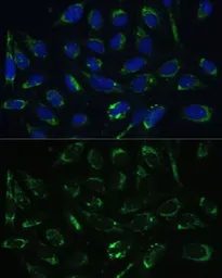 Anti-ERAB antibody used in Immunocytochemistry/ Immunofluorescence (ICC/IF). GTX33249
