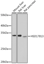 Anti-HSD17B13 antibody used in Western Blot (WB). GTX33250