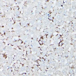 Anti-HSD17B13 antibody used in IHC (Paraffin sections) (IHC-P). GTX33250