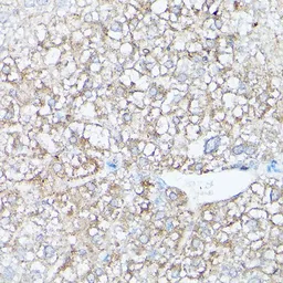 Anti-HSD17B13 antibody used in IHC (Paraffin sections) (IHC-P). GTX33250