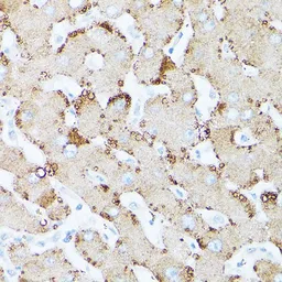 Anti-HSD17B13 antibody used in IHC (Paraffin sections) (IHC-P). GTX33250