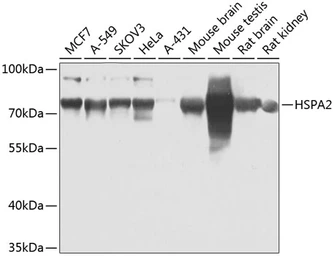 Anti-HSPA2 antibody used in Western Blot (WB). GTX33251