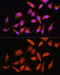 Anti-HSPA2 antibody used in Immunocytochemistry/ Immunofluorescence (ICC/IF). GTX33251