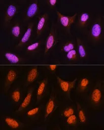 Anti-HSPA2 antibody used in Immunocytochemistry/ Immunofluorescence (ICC/IF). GTX33251
