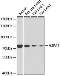 Anti-HSPA6 antibody used in Western Blot (WB). GTX33252
