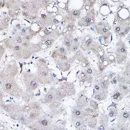 Anti-HSPA6 antibody used in IHC (Paraffin sections) (IHC-P). GTX33252