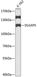 Anti-HURP antibody used in Western Blot (WB). GTX33253