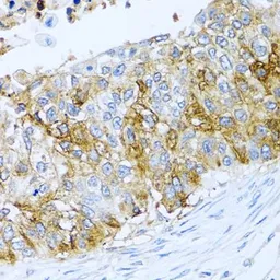 Anti-IFIT3 antibody used in IHC (Paraffin sections) (IHC-P). GTX33255