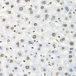 Anti-IGF2BP2 antibody used in IHC (Paraffin sections) (IHC-P). GTX33256