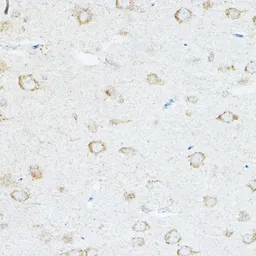 Anti-IL1RAP antibody used in IHC (Paraffin sections) (IHC-P). GTX33261