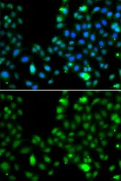 Anti-ING5 antibody used in Immunocytochemistry/ Immunofluorescence (ICC/IF). GTX33266