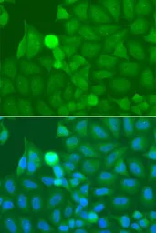 Anti-IRAK2 antibody used in Immunocytochemistry/ Immunofluorescence (ICC/IF). GTX33273