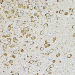 Anti-IRAK4 antibody used in IHC (Paraffin sections) (IHC-P). GTX33274