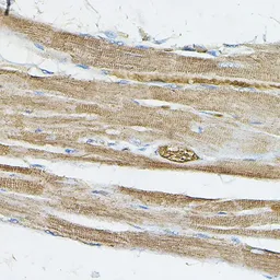 Anti-IRAK4 antibody used in IHC (Paraffin sections) (IHC-P). GTX33274