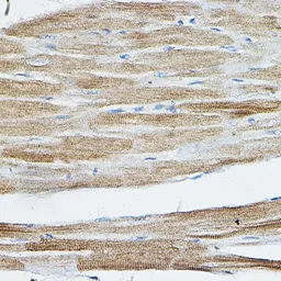 Anti-IRAK4 antibody used in IHC (Paraffin sections) (IHC-P). GTX33274