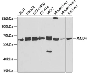 Anti-JMJD4 antibody used in Western Blot (WB). GTX33277