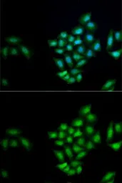 Anti-Kallikrein 10 antibody used in Immunocytochemistry/ Immunofluorescence (ICC/IF). GTX33280