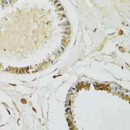 Anti-Kallikrein 10 antibody used in IHC (Paraffin sections) (IHC-P). GTX33280