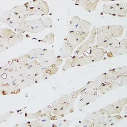 Anti-KDM4A antibody used in IHC (Paraffin sections) (IHC-P). GTX33282