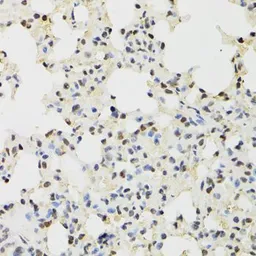 Anti-KDM4A antibody used in IHC (Paraffin sections) (IHC-P). GTX33282