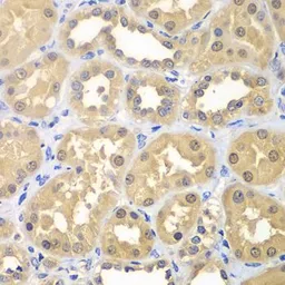 Anti-Ketohexokinase antibody used in IHC (Paraffin sections) (IHC-P). GTX33283