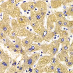 Anti-KIF1B antibody used in IHC (Paraffin sections) (IHC-P). GTX33285