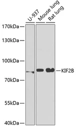 Anti-KIF2B antibody used in Western Blot (WB). GTX33286