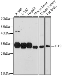 Anti-KLF9 antibody used in Western Blot (WB). GTX33288