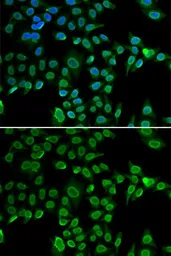Anti-Lamin B2 antibody used in Immunocytochemistry/ Immunofluorescence (ICC/IF). GTX33292