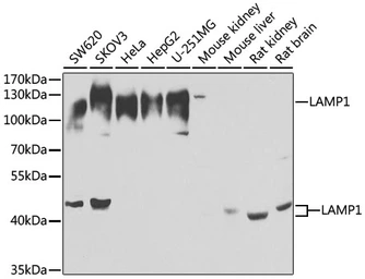 Anti-LAMP1 antibody used in Western Blot (WB). GTX33293