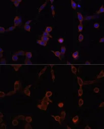 Anti-LAMP1 antibody used in Immunocytochemistry/ Immunofluorescence (ICC/IF). GTX33293