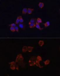Anti-LAMP1 antibody used in Immunocytochemistry/ Immunofluorescence (ICC/IF). GTX33293