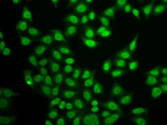 Anti-LMP2 antibody used in Immunocytochemistry/ Immunofluorescence (ICC/IF). GTX33298