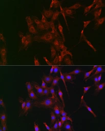 Anti-LOX antibody used in Immunocytochemistry/ Immunofluorescence (ICC/IF). GTX33299