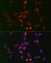 Anti-LOX antibody used in Immunocytochemistry/ Immunofluorescence (ICC/IF). GTX33299