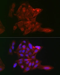 Anti-LOX antibody used in Immunocytochemistry/ Immunofluorescence (ICC/IF). GTX33299