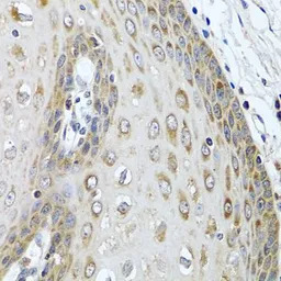 Anti-LRG1 antibody used in IHC (Paraffin sections) (IHC-P). GTX33301