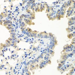 Anti-LRG1 antibody used in IHC (Paraffin sections) (IHC-P). GTX33301