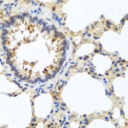 Anti-LRG1 antibody used in IHC (Paraffin sections) (IHC-P). GTX33301