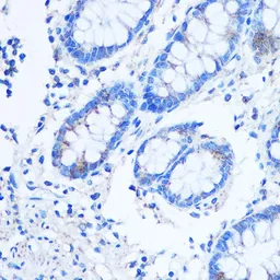 Anti-LRP130 antibody used in IHC (Paraffin sections) (IHC-P). GTX33302