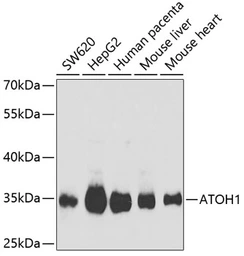 Anti-MATH1 antibody used in Western Blot (WB). GTX33306