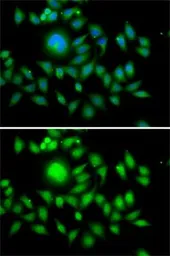 Anti-MATH1 antibody used in Immunocytochemistry/ Immunofluorescence (ICC/IF). GTX33306