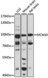 Anti-MCM10 antibody used in Western Blot (WB). GTX33309