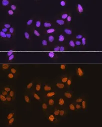 Anti-MCM5 antibody used in Immunocytochemistry/ Immunofluorescence (ICC/IF). GTX33310