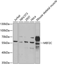 Anti-MEF2C antibody used in Western Blot (WB). GTX33312