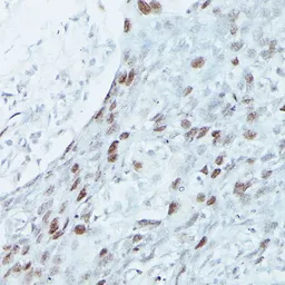 Anti-MEF2C antibody used in IHC (Paraffin sections) (IHC-P). GTX33312